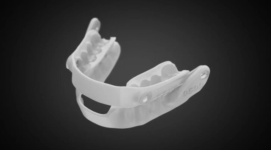 Orthèse d'avancée mandibulaire sur mesure
